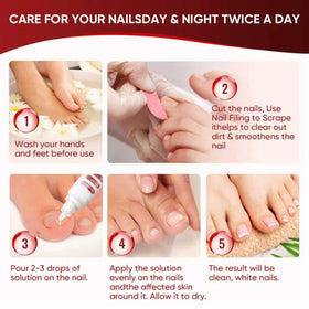 DERMFREE before and after toenails comparison highlighting improved appearance