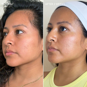 Dermisa in bathroom routine setting showing daily use convenience