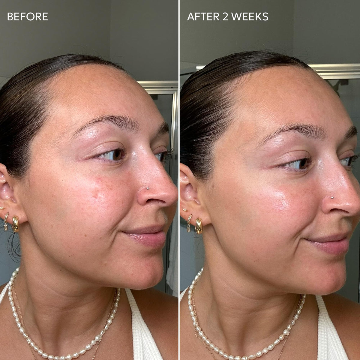 Dermisa ingredient close-up with vitamin C and licorice highlighting brightening