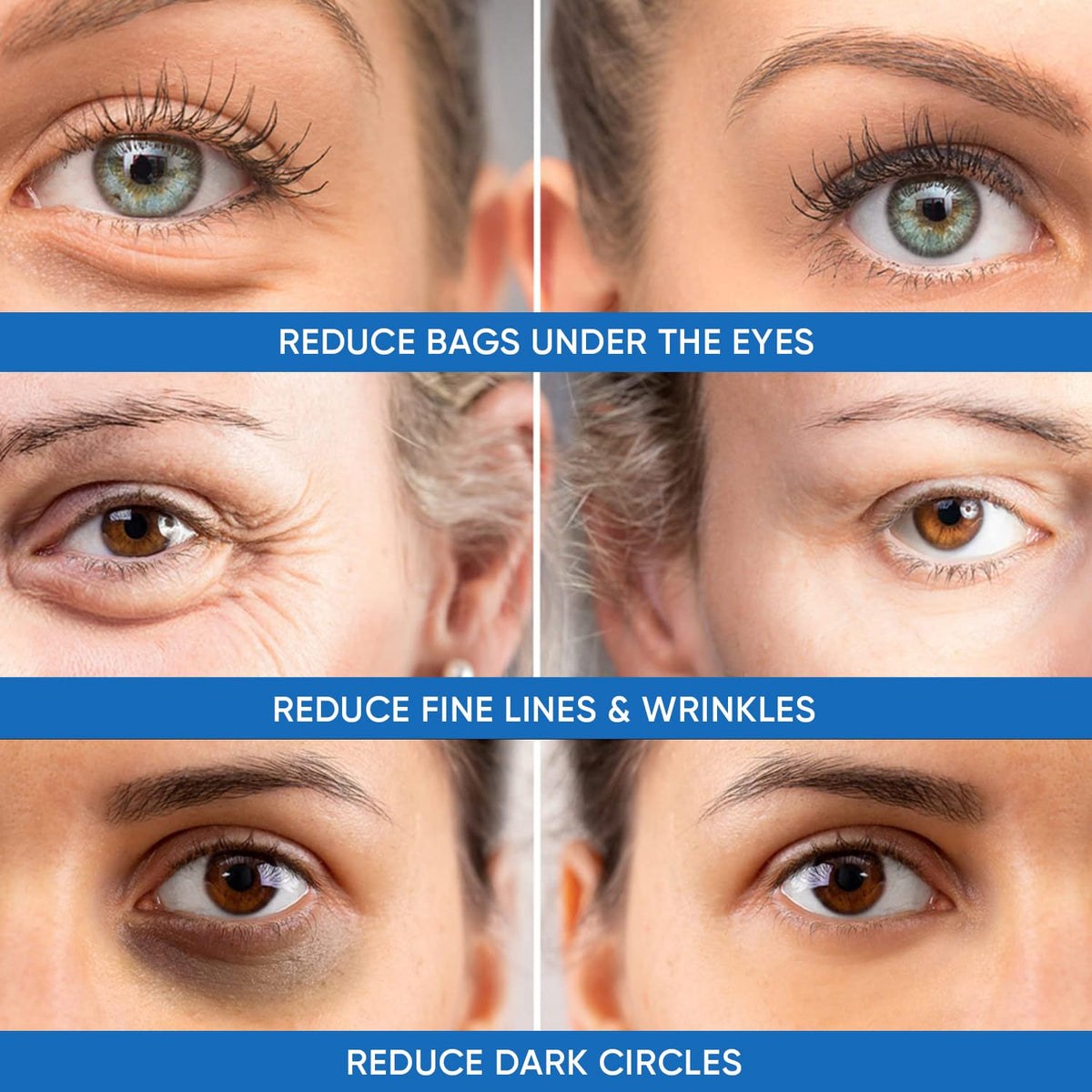Dermlogic being applied under eye for immediate tightening effect
