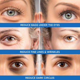 Dermlogic being applied under eye for immediate tightening effect