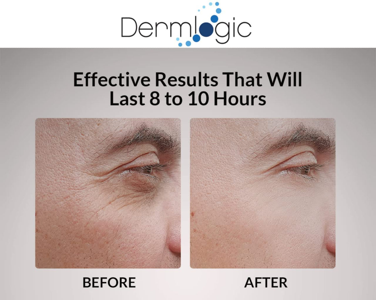 Dermlogic before and after comparison showing reduced puffiness