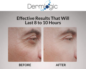 Dermlogic before and after comparison showing reduced puffiness