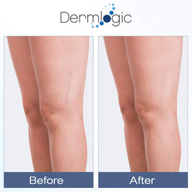 Dermlogic ingredients display with arnica and vitamin K emphasizing healing support