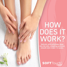 Dermora peeling progress on heels days later revealing smoother skin benefit