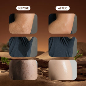 Derperzi being applied to shoulder demonstrating smooth spreadability and non-greasy finish benefit