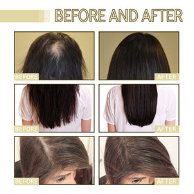 Deuiosna application scalp massage demonstration promoting better absorption and circulation