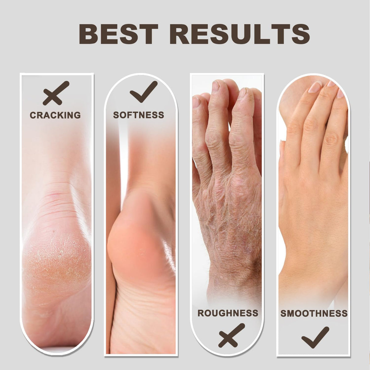 Devyonder being applied to heels demonstrating effective callus softening and hydration