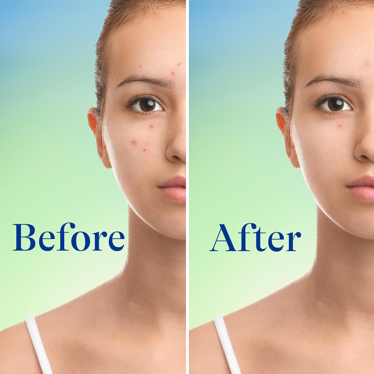 Differin label close-up showing 10% benzoyl peroxide strength clearly