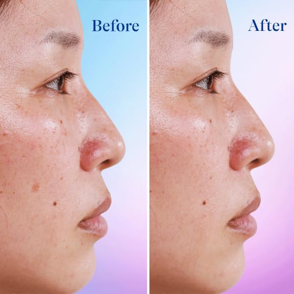 Differin sea buckthorn berry oil ingredient close-up providing antioxidant soothing