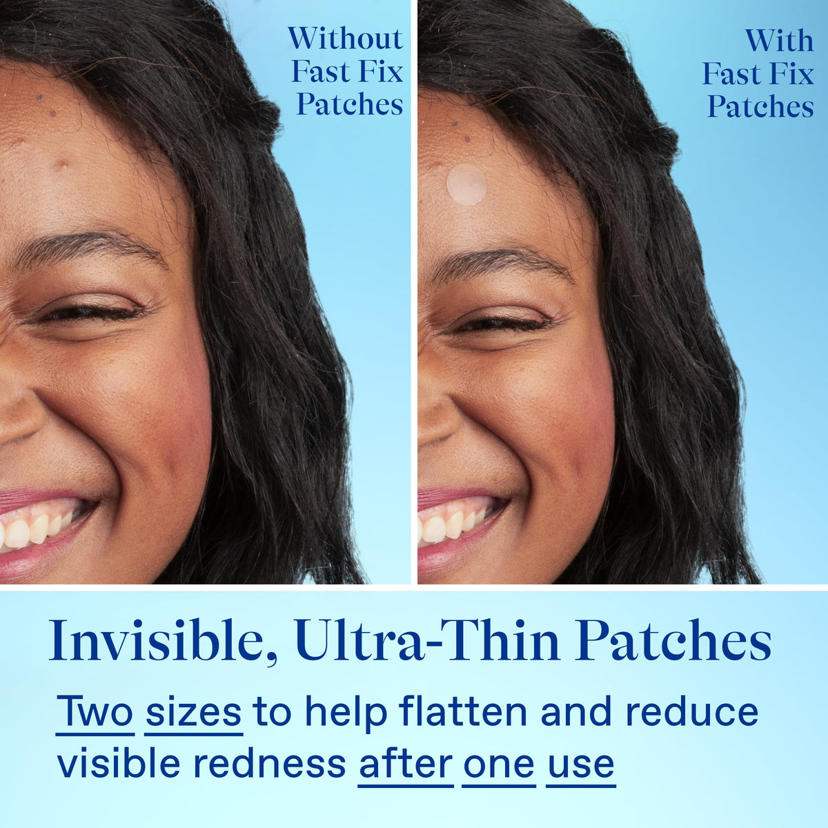 Differin product label close-up listing centella asiatica and niacinamide, benefit calming and redness reduction