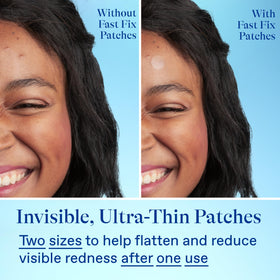 Differin product label close-up listing centella asiatica and niacinamide, benefit calming and redness reduction