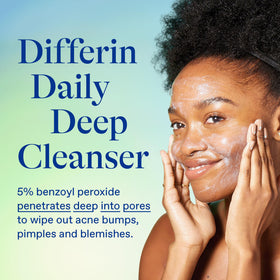 Differin lather on hand demonstrating gentle foaming that removes oil