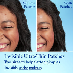 Differin travel pouch with tube and patches showing convenient on-the-go benefit