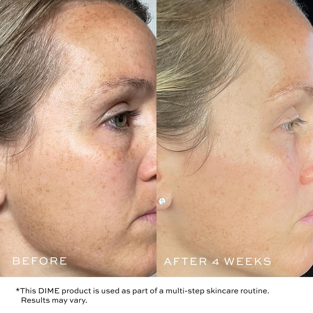 DIME TBT Cream bakuchiol ingredient focus highlighting natural retinol alternative