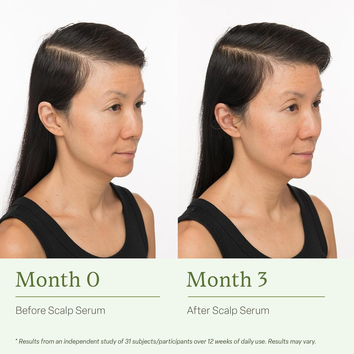 divi scalp serum applied to scalp demonstrating targeted use and refreshed feel