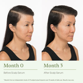 divi scalp serum applied to scalp demonstrating targeted use and refreshed feel