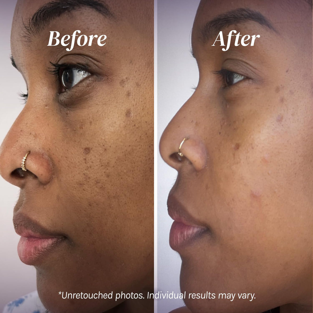 Divine Derriere mulberry and kojic ingredients visual emphasizing brightening