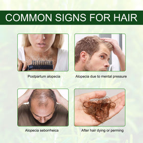 man massaging DLOMFVFQ rosemary oil into beard to show grooming and conditioning benefit
