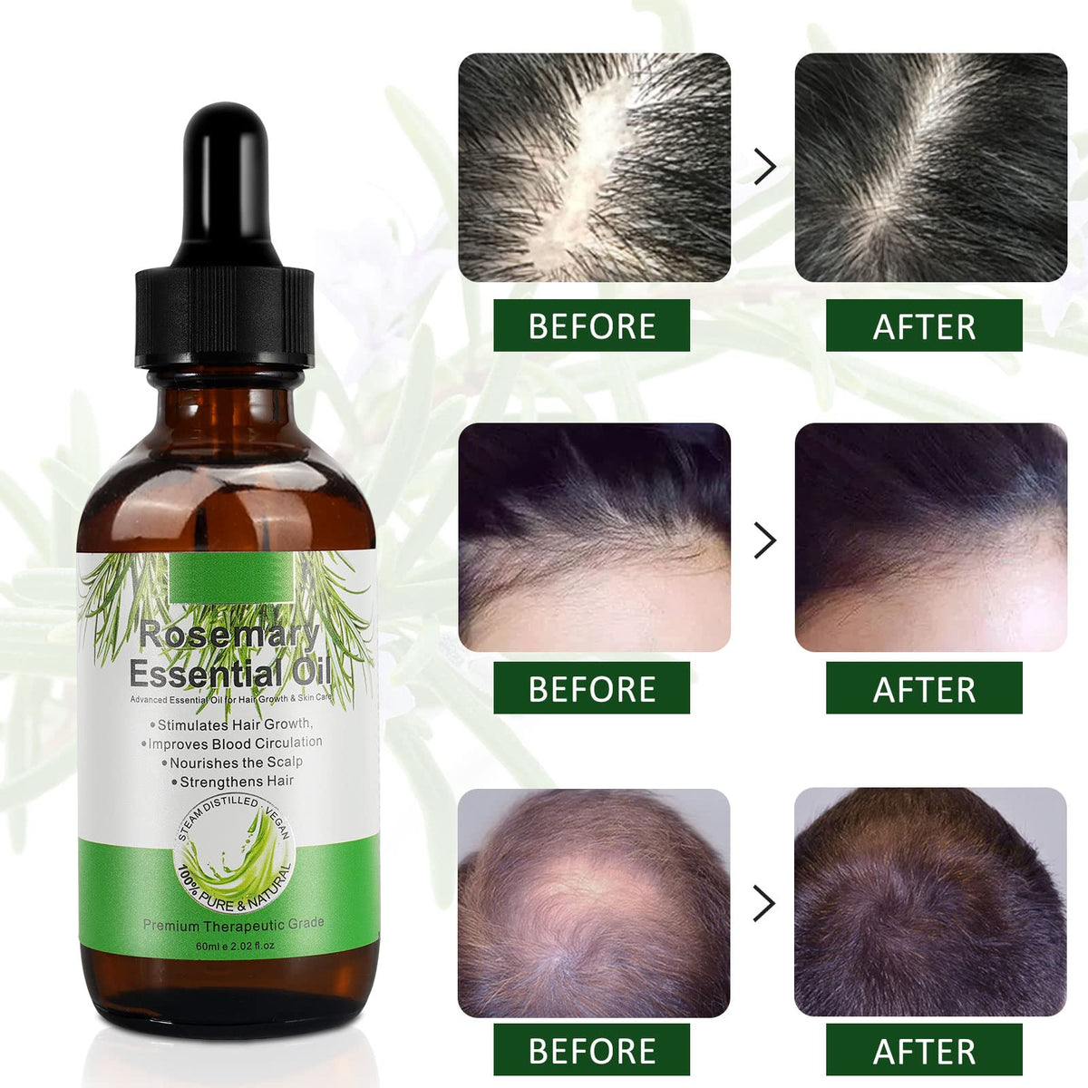 applying diluted DLOMFVFQ rosemary oil to scalp demonstrating massage application benefit