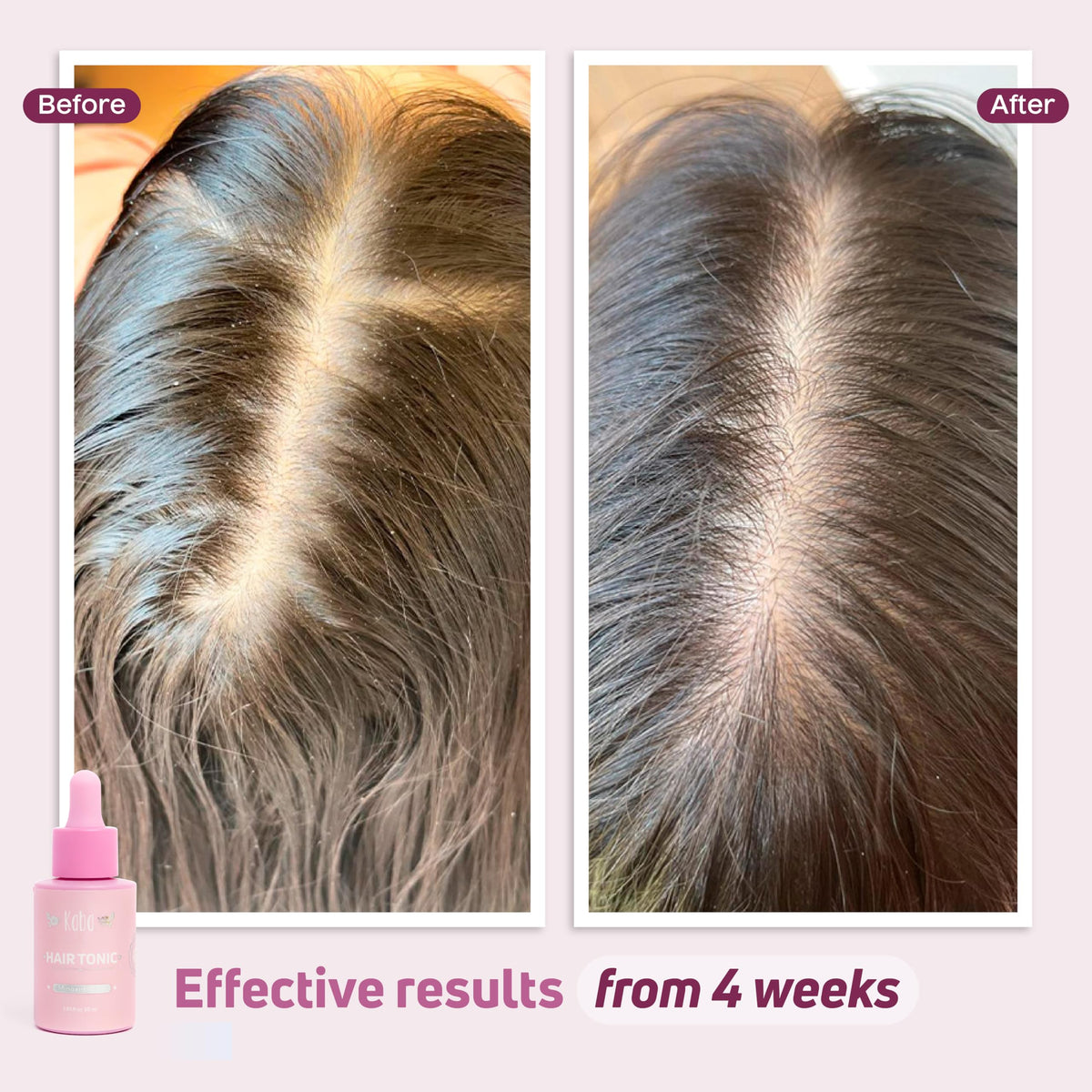 D'Luchi Kaba Tonic dropper detail dispensing serum for precise, mess-free application