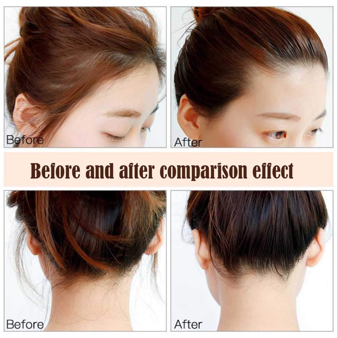DMLNN applicator close-up revealing gel texture for precise control