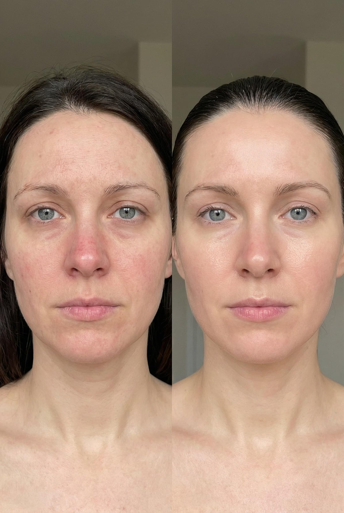 DOLL 10 before and after texture comparison showing visible smoothing benefit