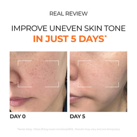 DOMINAS illustrative before and after spot area highlighting visible fade benefit