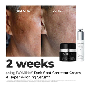 DOMINAS cream application on hand demonstrating easy spread and hydration