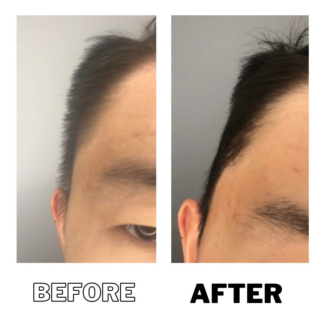 DPERM after-treatment slick look showcasing polished finish and reduced bulk