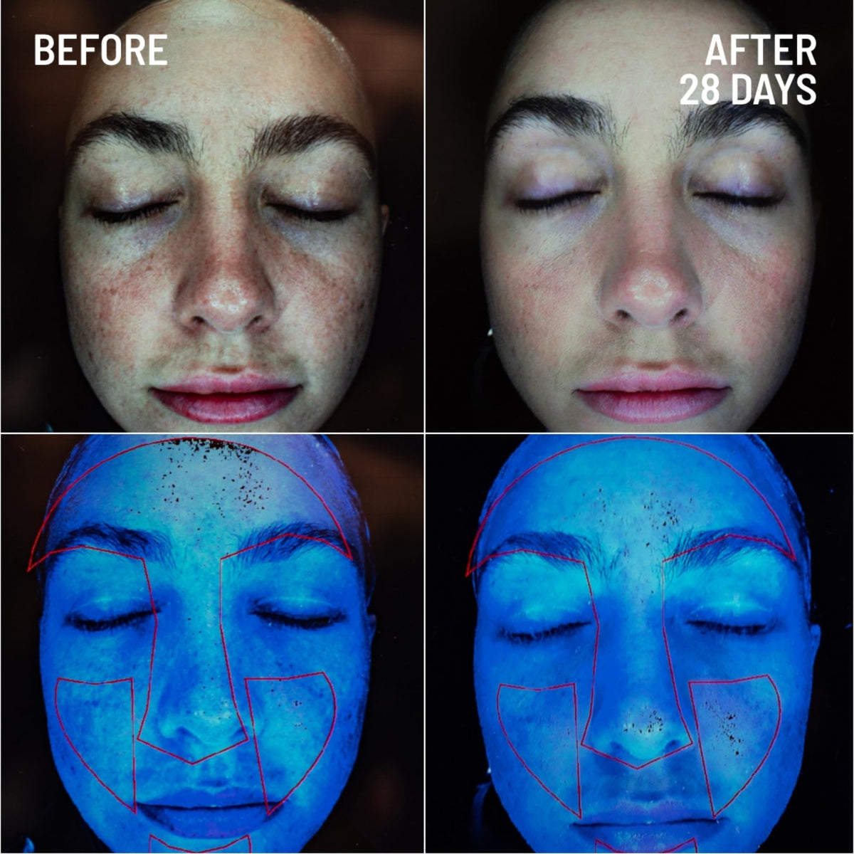 Dr. Brandt product on fingertip demonstrating simple application and control