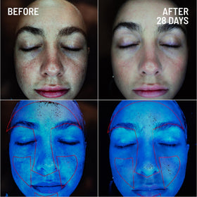 Dr. Brandt product on fingertip demonstrating simple application and control