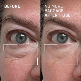 Dr. Brandt before and after under-eye showing reduced puffiness benefit