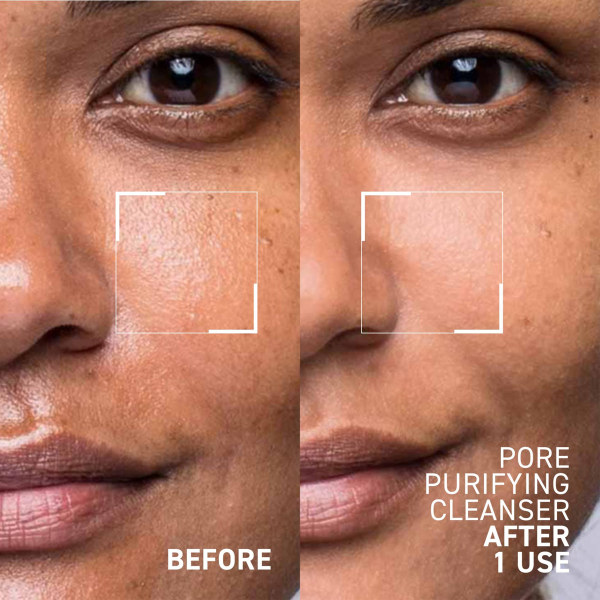 Dr. Brandt gel texture close-up highlighting smooth consistency for effective cleansing