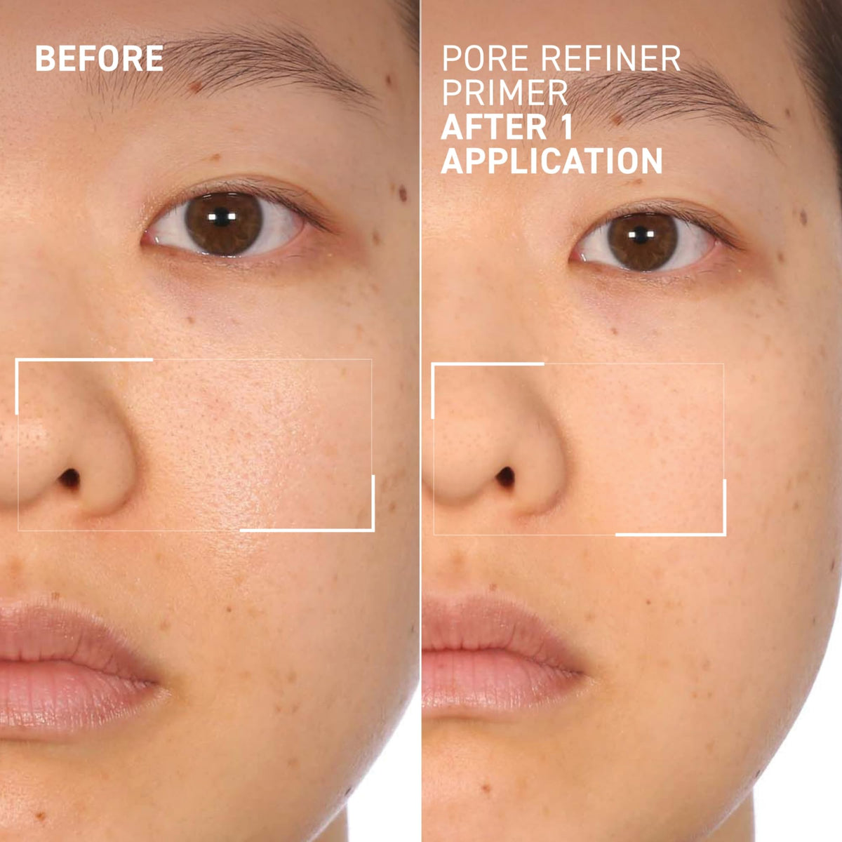 Dr. Brandt before-and-after split face showing reduced pores and shine