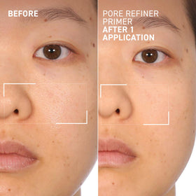 Dr. Brandt before and after cheek showing reduced pore visibility