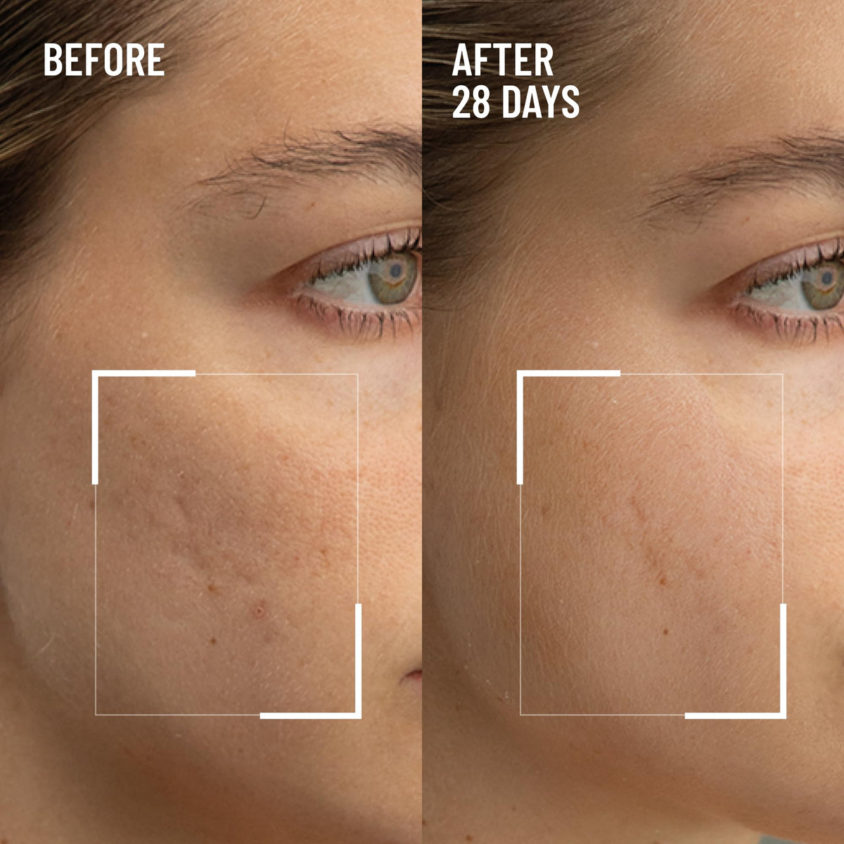 Dr. Brandt close-up cream texture revealing gentle microgranules for smoothness