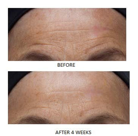 Dr. Denese shows improved serum absorption on skin after pad use