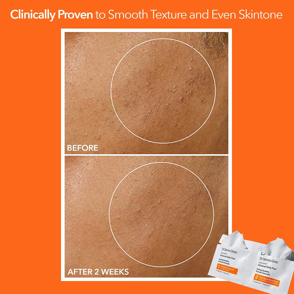 Dr Dennis Gross pad being applied to face showing easy at-home peel