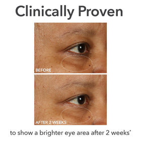 Dr Dennis Gross tapping application around eye for even absorption benefit