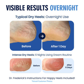 Dr. Frederick's socks worn overnight in bed demonstrating restful repair