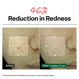 Dr. G cream applied on hand demonstrating lightweight absorption benefit