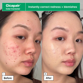 Dr.Jart+ moisturizer open jar showing cream texture and calming effect