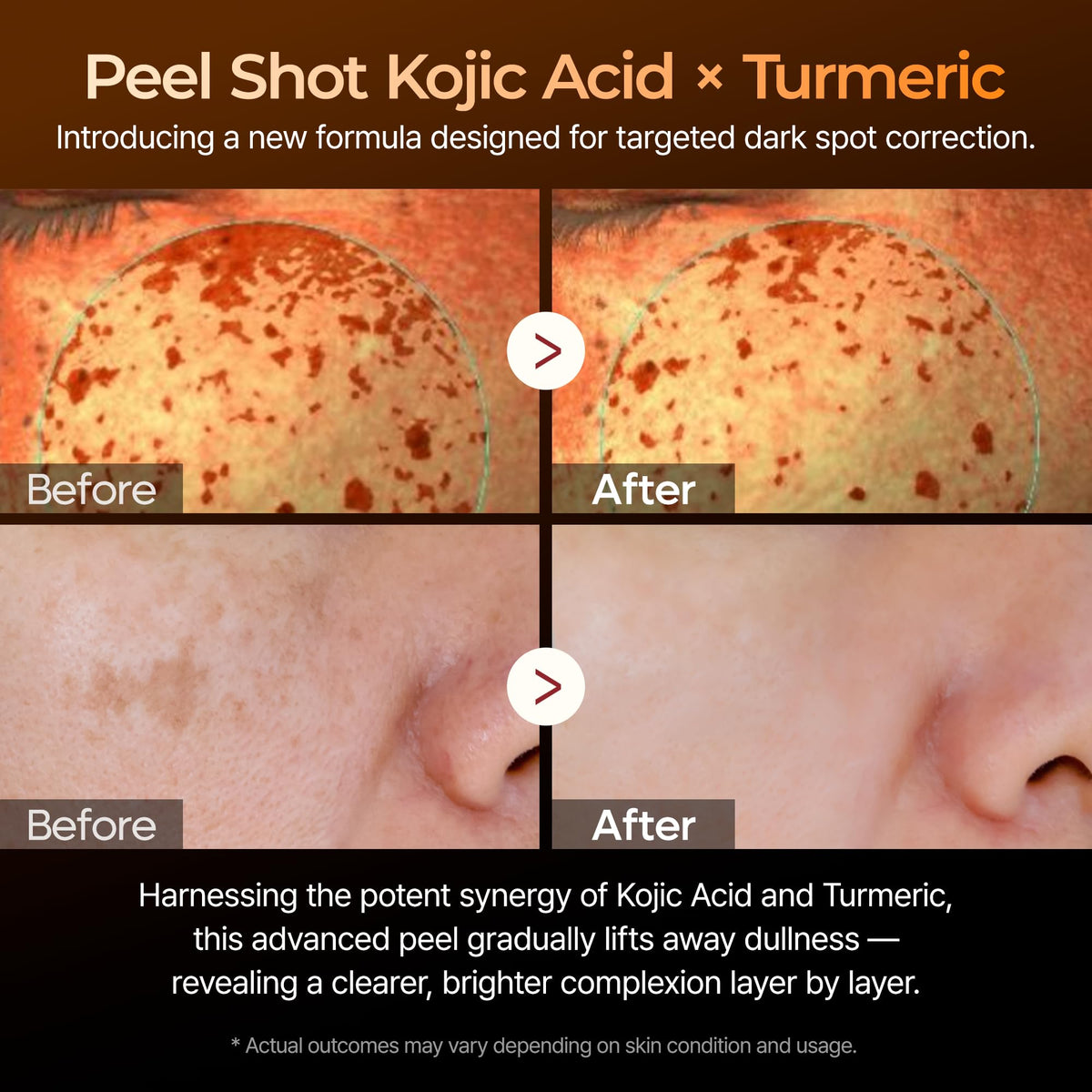 Dr.Melaxin ingredient label close-up listing kojic acid turmeric niacinamide benefits