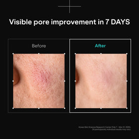 Dr.nineteen dropper detail releasing serum emphasizing precise application benefit