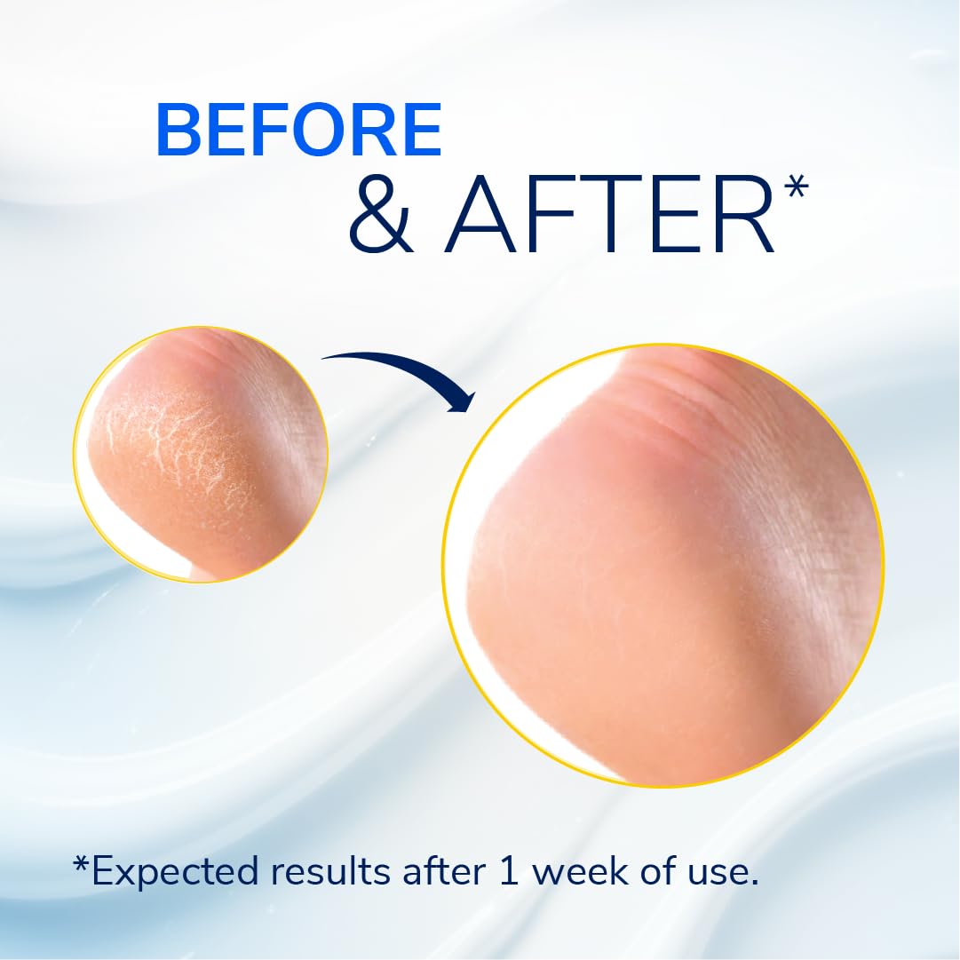 Dr. Scholl's balm being applied to heel for targeted moisturization