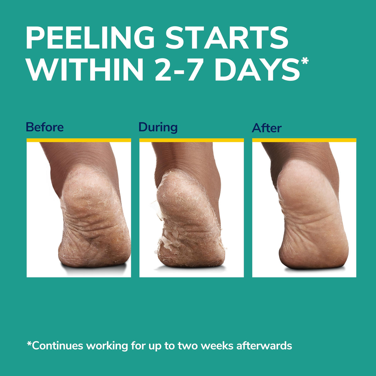 Person wearing Dr. Scholl's exfoliating socks showing comfortable at-home use