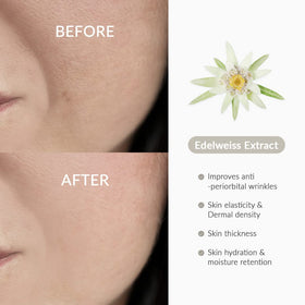 Dr.Althea edelweiss extract close-up highlighting botanical antioxidant benefit