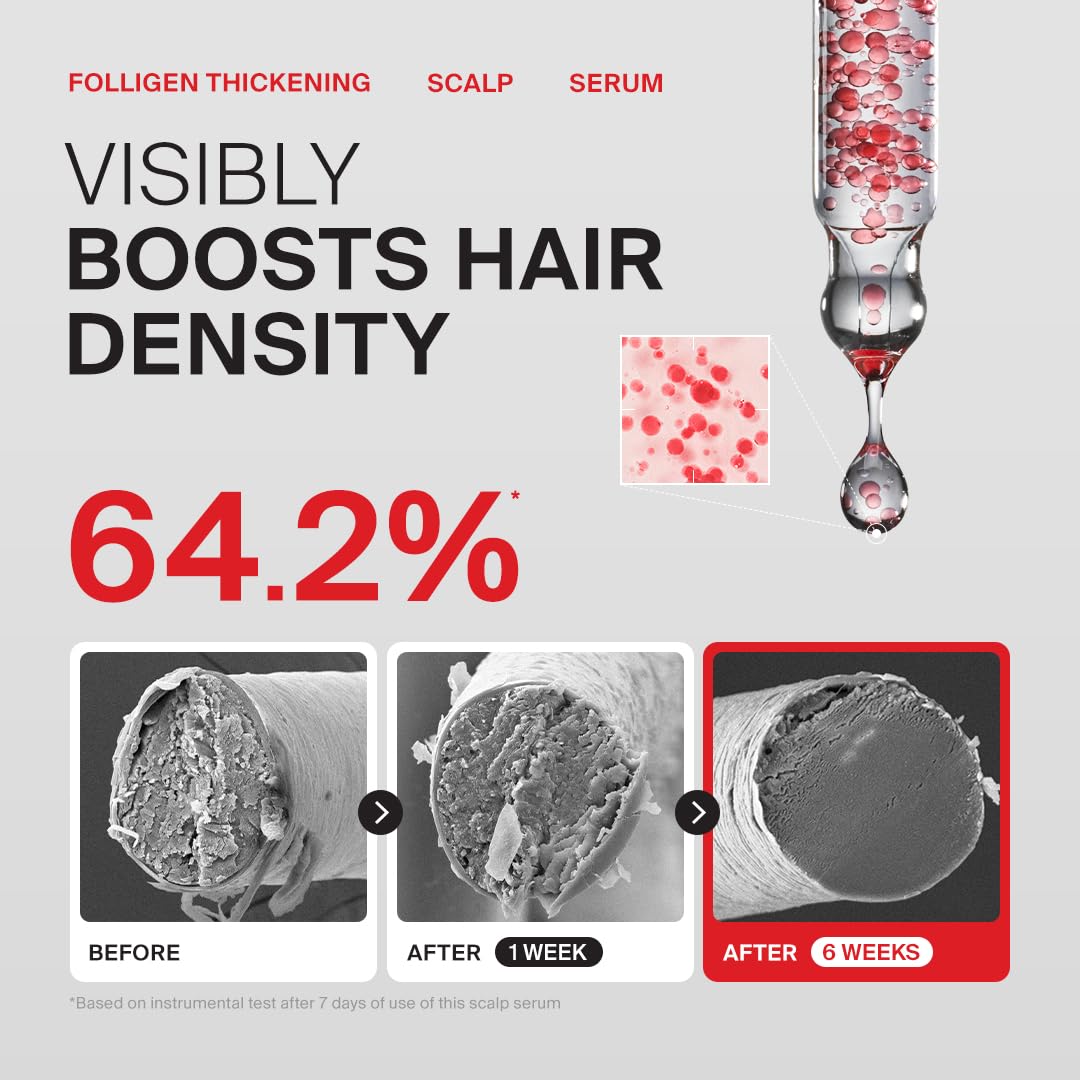 Dr.FORHAIR before and after hair showing improved visual volume