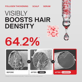 Dr.FORHAIR before and after hair showing improved visual volume